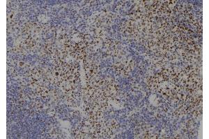 ABIN6277766 at 1/100 staining Mouse spleen tissue by IHC-P. (SMC3 antibody  (C-Term))