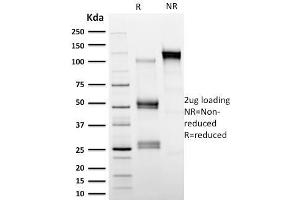 SDS-PAGE Analysis Purified Calpastatin Mouse Monoclonal Antibody (CAST/1550). (Calpastatin antibody)