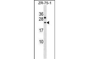 Western blot analysis in ZR-75-1 cell line lysates (35ug/lane). (CCDC140 antibody  (N-Term))