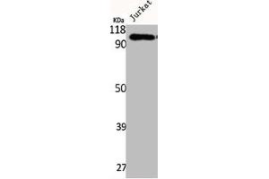 Western Blot analysis of Jurkat cells using Integrin β5 Polyclonal Antibody