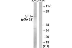 Western blot analysis of extracts from HUVEC cells treated with anisomycin using SF1 (Phospho-Ser82) Antibody. (Splicing Factor 1 antibody  (pSer82))