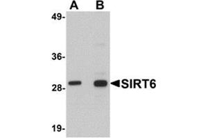 Western blot analysis of SIRT6 in HeLa cell lysate with SIRT6 antibody at (A) 0.