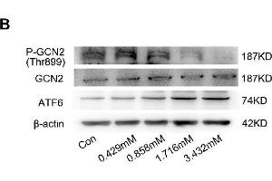 BCAA increase PPAR-α expression in a GCN2/ATF6 pathway-dependent manner.