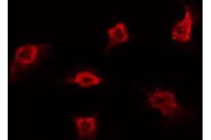 ABIN6272368 staining A549 by IF/ICC. (POU3F1 antibody  (Internal Region))