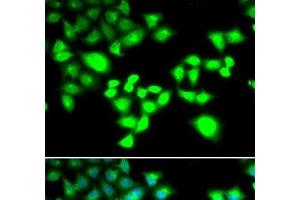Immunofluorescence analysis of MCF-7 cells using RAD1 Polyclonal Antibody (RAD1 antibody)