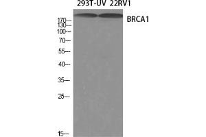 Western Blotting (WB) image for anti-Breast Cancer 1 (BRCA1) (Ser1423) antibody (ABIN5959016) (BRCA1 antibody  (Ser1423))