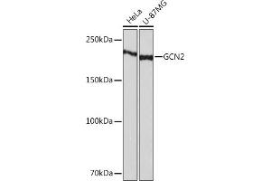Western blot analysis of extracts of various cell lines, using GCN2 Rabbit mAb (ABIN1679532, ABIN3015972, ABIN3015973 and ABIN7101471) at 1:1000 dilution. (GCN2 antibody)