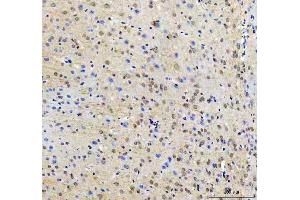 IHC analysis of RTF1 using anti-RTF1 antibody (ABIN7602444). (RTF1 antibody  (AA 77-705))
