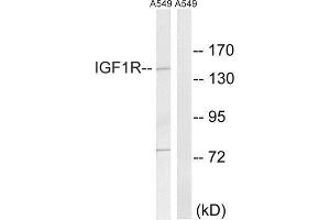 Western Blotting (WB) image for anti-Insulin-Like Growth Factor 1 Receptor (IGF1R) (Tyr1346) antibody (ABIN1848191) (IGF1R antibody  (Tyr1346))