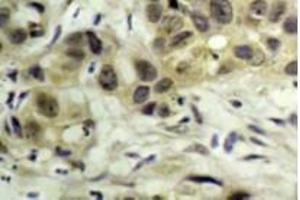 Image no. 3 for anti-Nibrin (NBN) (pSer343) antibody (ABIN318326) (Nibrin antibody  (pSer343))