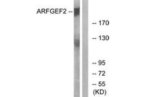 Western blot analysis of extracts from A549 cells, using ARFGEF2 Antibody. (ARFGEF2 antibody  (AA 1491-1540))