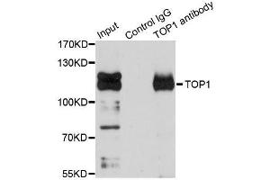 Immunoprecipitation analysis of 150ug extracts of Jurkat cells using 3ug TOP1 antibody. (Topoisomerase I antibody  (AA 1-100))