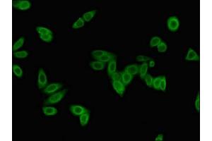 Immunofluorescent analysis of HepG2 cells using ABIN7157858 at dilution of 1:100 and Alexa Fluor 488-congugated AffiniPure Goat Anti-Rabbit IgG(H+L) (Lamin B2 antibody  (AA 442-615))