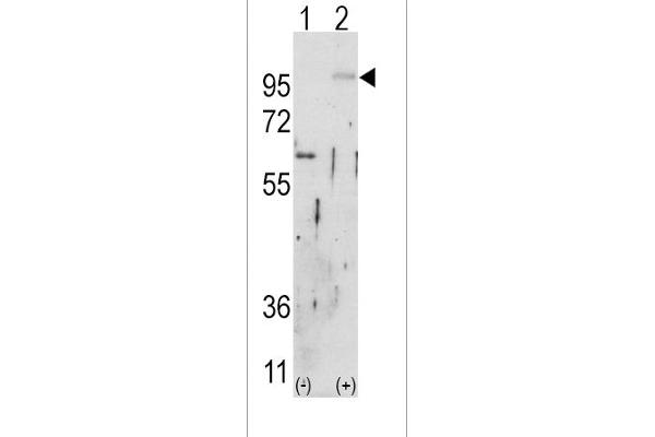 FGFR2 antibody