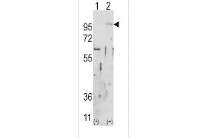Western blot analysis of FGFR2 (arrow) using rabbit polyclonal FGFR2 Antibody (ABIN391968 and ABIN2841764). (FGFR2 antibody)