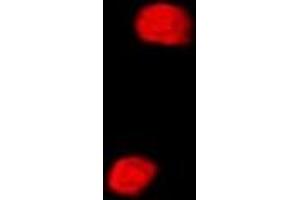 Immunofluorescent analysis of SETD5 staining in MCF7 cells. (SETD5 antibody)