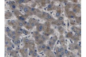 DAB staining on IHC-P; Samples: Human Liver Tissue (GABBR1 antibody  (AA 199-570))