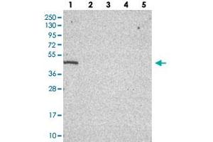 Western blot analysis of Lane 1: RT-4, Lane 2: U-251 MG, Lane 3: Human Plasma, Lane 4: Liver, Lane 5: Tonsil with C19orf47 polyclonal antibody  at 1:100-1:250 dilution.