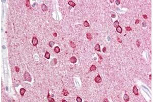 Anti-PACSIN1 antibody IHC staining of human brain, cortex. (PACSIN1 antibody  (AA 2-15))