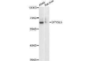 Western blot analysis of extracts of various cell lines, using DPYSL5 antibody (ABIN6291929) at 1:3000 dilution.