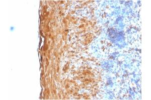 Formalin-fixed, paraffin-embedded human Tonsil stained with Involucrin Rabbit Recombinant Monoclonal Antibody (IVRN/2113R). (Recombinant Involucrin antibody)