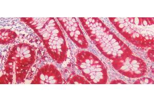 Detection of GAL3 in Human Colon Tissue using Polyclonal Antibody to Galectin 3 (GAL3) (Galectin 3 antibody)