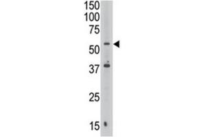 Western Blotting (WB) image for anti-Septin 9 (SEPT9) antibody (ABIN3002552)