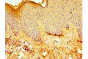 Immunohistochemistry of paraffin-embedded human skin tissue using ABIN7171956 at dilution of 1:100