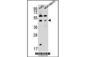 Western blot analysis in K562,MDA-MB453 cell line lysates (35ug/lane). (SNX29 antibody  (C-Term))