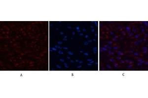 Immunofluorescence analysis of human breast cancer tissue. (TUBB1 antibody)