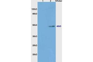 Lane 1: mouse spleen lysates Lane 2: mouse liver lysates probed with Anti caspase-8 subunit p18 Polyclonal Antibody, Unconjugated (ABIN1386778) at 1:200 in 4 °C. (Caspase 8 antibody  (AA 188-280))