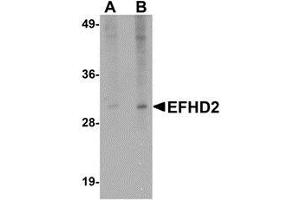 Western blot analysis of EFHD2 in mouse brain tissue lysate with AP30310PU-N EFHD2 antibody at (A) 1 and (B) 2 μg/ml.