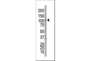 Western blot analysis of anti-EphA7 Pab (ABIN391899 and ABIN2841717) in NCI- cell lysate. (EPH Receptor A7 antibody  (C-Term))