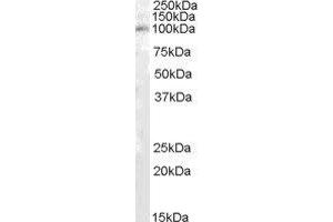 ABIN2564372 (1µg/ml) staining of Human Kidney lysate (35µg protein in RIPA buffer).