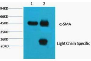 Immunoprecipitation (IP) analysis: 1) Input: Mouse Brain Tissue Lysate. (Actin antibody)