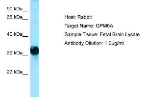 Host: Rabbit  Target Name: GPM6A  Antibody Dilution: 1. (GPM6A antibody  (C-Term))