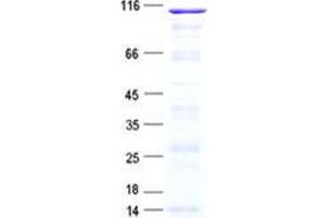 PDZ Domain Containing 4 (PDZD4) protein (His tag)