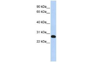 FAM119A antibody used at 1 ug/ml to detect target protein. (FAM119A antibody  (N-Term))