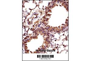 Mouse Hoxc10 Antibody immunohistochemistry analysis in formalin fixed and paraffin embedded mouse lung tissue followed by peroxidase conjugation of the secondary antibody and DAB staining. (HOXC10 antibody  (C-Term))