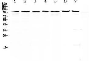 Western blot analysis of Topoisomerase I using anti-Topoisomerase I antibody . (Topoisomerase I antibody  (AA 526-765))