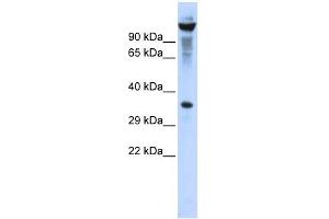 RNASET2 antibody used at 1 ug/ml to detect target protein. (RNASET2 antibody  (Middle Region))