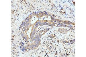 IHC analysis of GIT1 using anti-GIT1 antibody (ABIN7601683). (GIT1 antibody  (AA 415-736))
