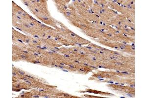IHC analysis of ACTN2 using anti-ACTN2 antibody (ABIN7602055). (ACTN2 antibody  (AA 567-696))
