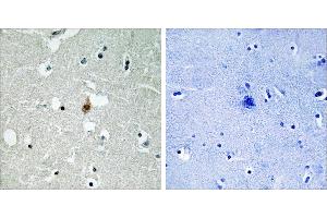 Peptide - +Immunohistochemistry analysis of paraffin-embedded human brain tissue usingantibody. (TCF3 antibody  (Internal Region))