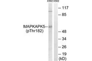 Western blot analysis of extracts from K562 cells treated with Na3VO4 0. (MAPKAP Kinase 5 antibody  (pThr182))