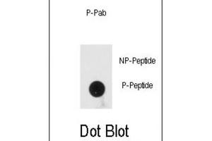Dot Blot (DB) image for anti-Protein Kinase, Interferon-Inducible Double Stranded RNA Dependent Activator (PRKRA) (pSer246) antibody (ABIN3001881)