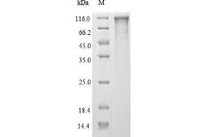 (Tris-Glycine gel) Discontinuous SDS-PAGE (reduced) with 5 % enrichment gel and 15 % separation gel. (SARS-CoV-2 Spike S1 Protein (His tag,DYKDDDDK Tag))