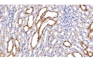 Immunohistochemistry (IHC) image for anti-Lipocalin 2 (LCN2) (AA 21-198) antibody (ABIN7427504)