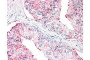 Anti-SLC39A14 antibody IHC of human prostate. (SLC39A14 antibody  (Internal Region))