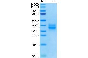 Mouse FOLR1 on Tris-Bis PAGE under reduced condition. (FOLR1 Protein (AA 25-232) (His tag))